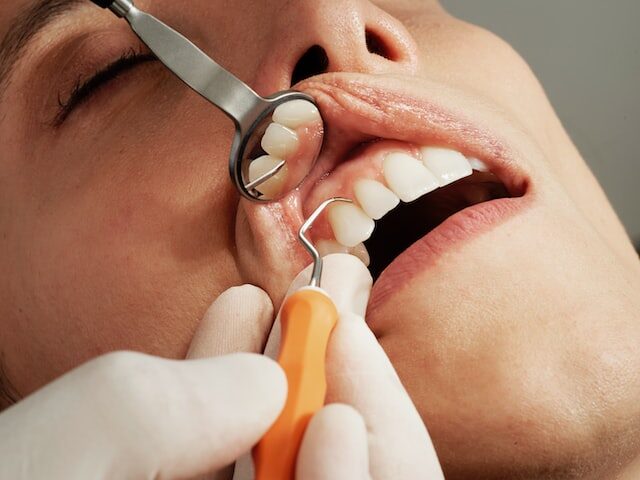 extractii dentare